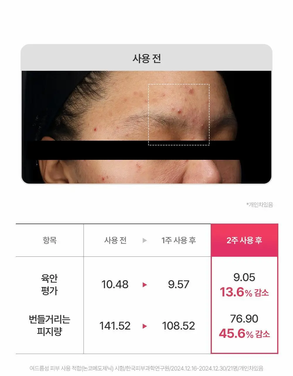 [여드름기능성] 파티온 노스카나인 트러블 패드 60매 상세페이지 12